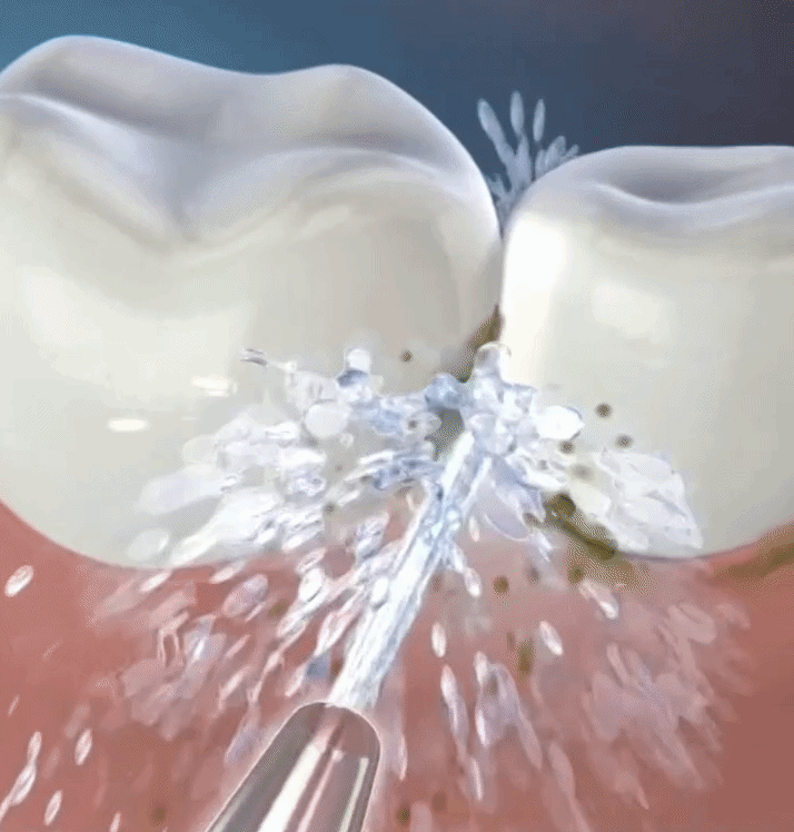 FlowDent vattenflosser